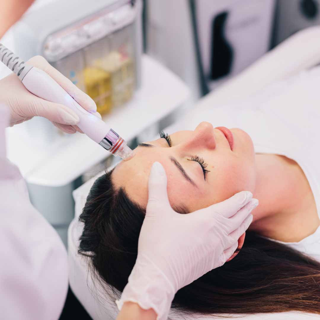 Aquafacial Behandlung bei Beauty Lounge Weiden