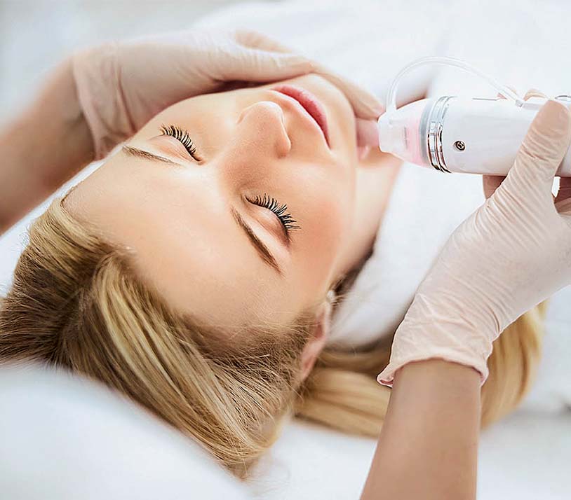 RF Microneedling Behandlung zur Hautstraffung bei Beauty Lounge Weiden